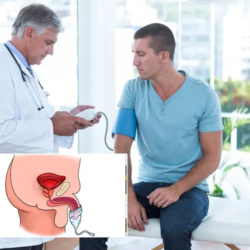 Frequently Asked Questions About Penile Implants