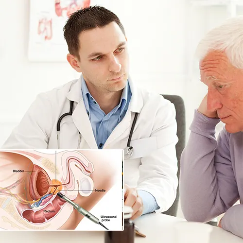 Understanding the Journey: The Penile Implant Process